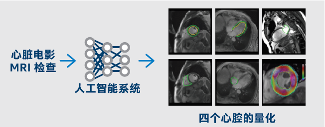 Xeon 可扩展处理器来加快心脏 MRI 的人工智能分析速度